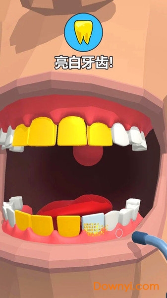 洗牙 洗牙