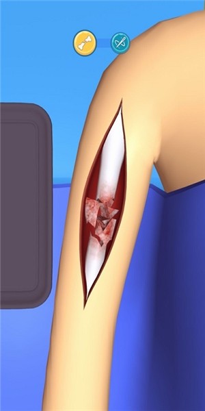 Surgery Master(外科手术大师) Surgery Master(外科手术大师)